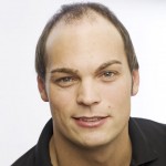 Imagen de un hombre con alopecia avanzada previo a recibir tratamiento de integración capilar