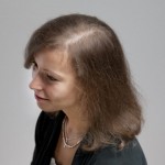 Mujer antes de recibir sistemas de cabello Hair & Hair imagen